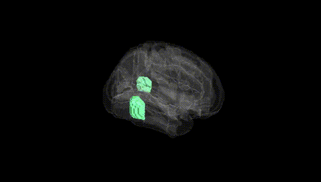 Full Brain Black