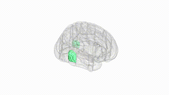 Full Brain White
