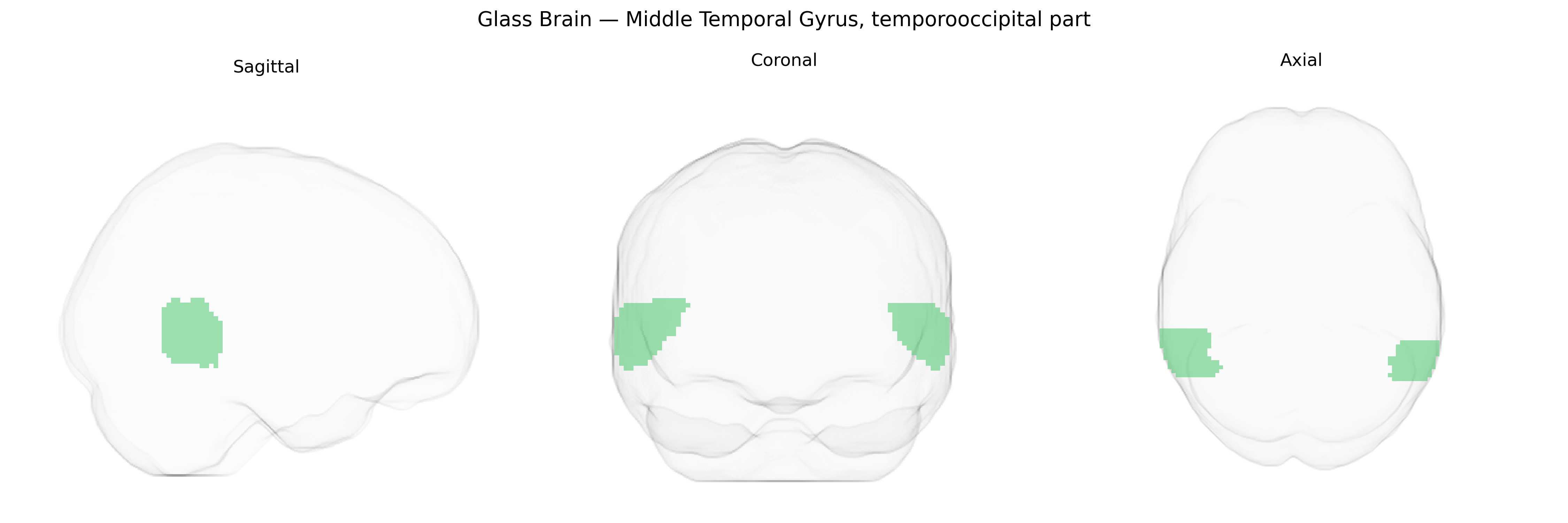 Triplanar Ghost Brain