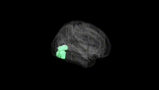 Full Brain Black