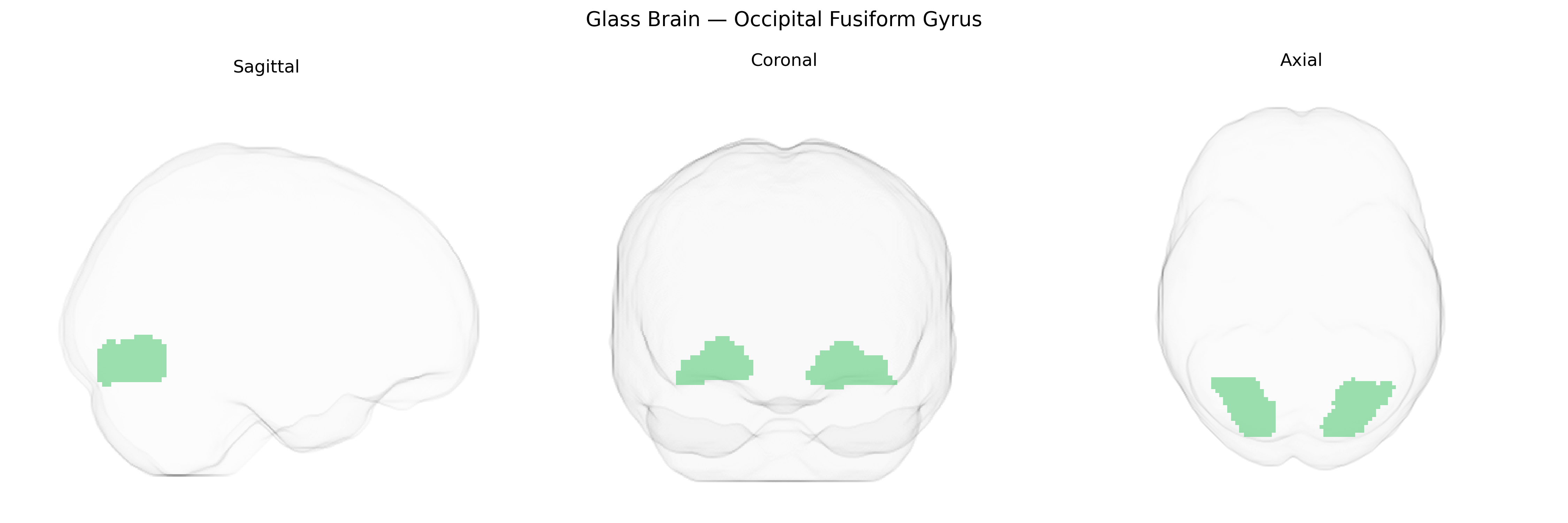 Triplanar Ghost Brain