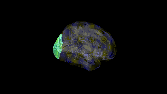Full Brain Black