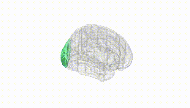 Full Brain White