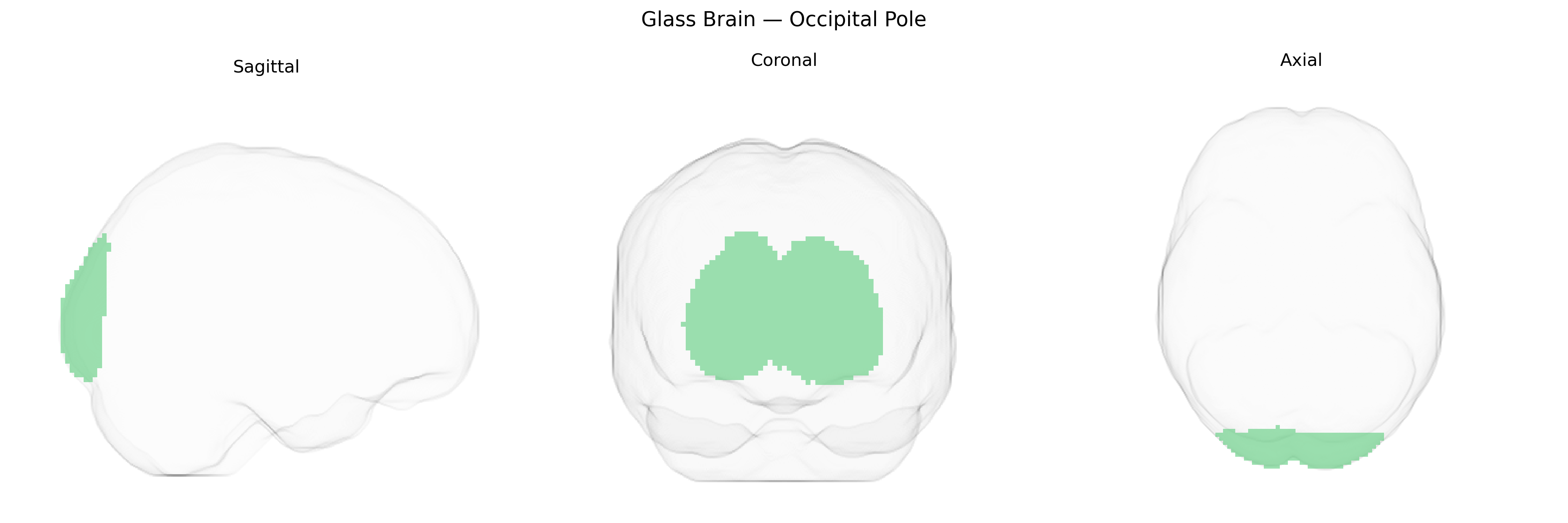 Triplanar Ghost Brain