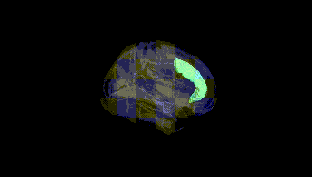 Full Brain Black