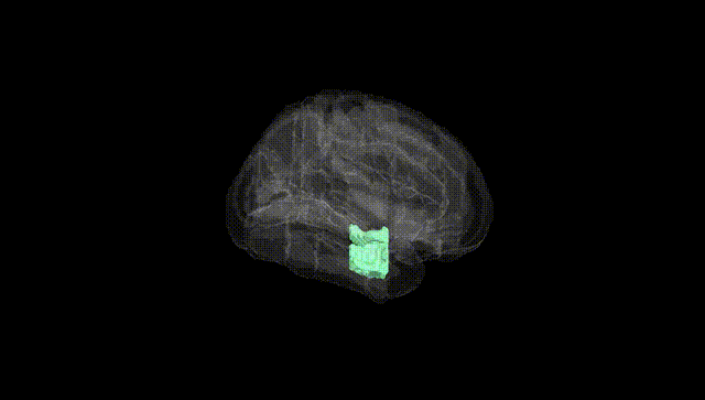 Full Brain Black