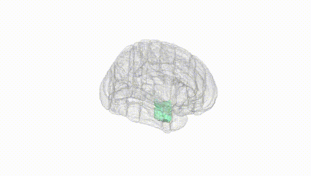 Full Brain White