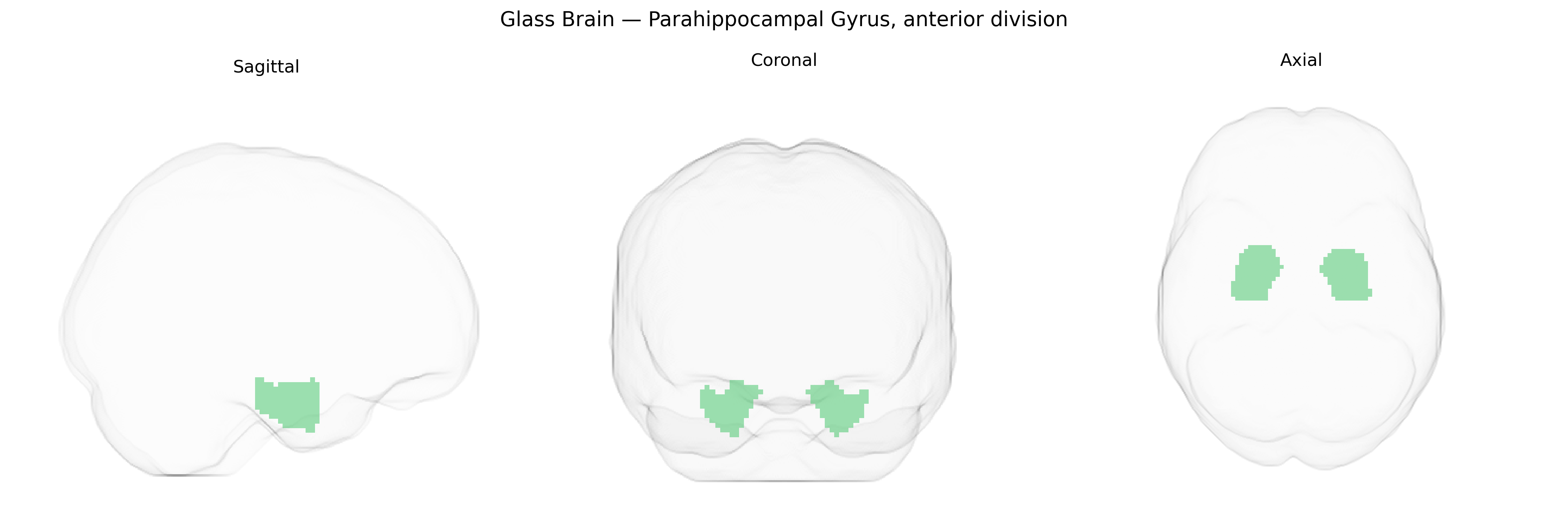 Triplanar Ghost Brain
