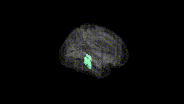 Full Brain Black