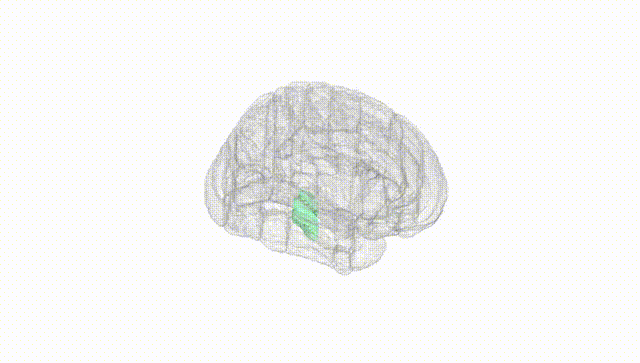Full Brain White