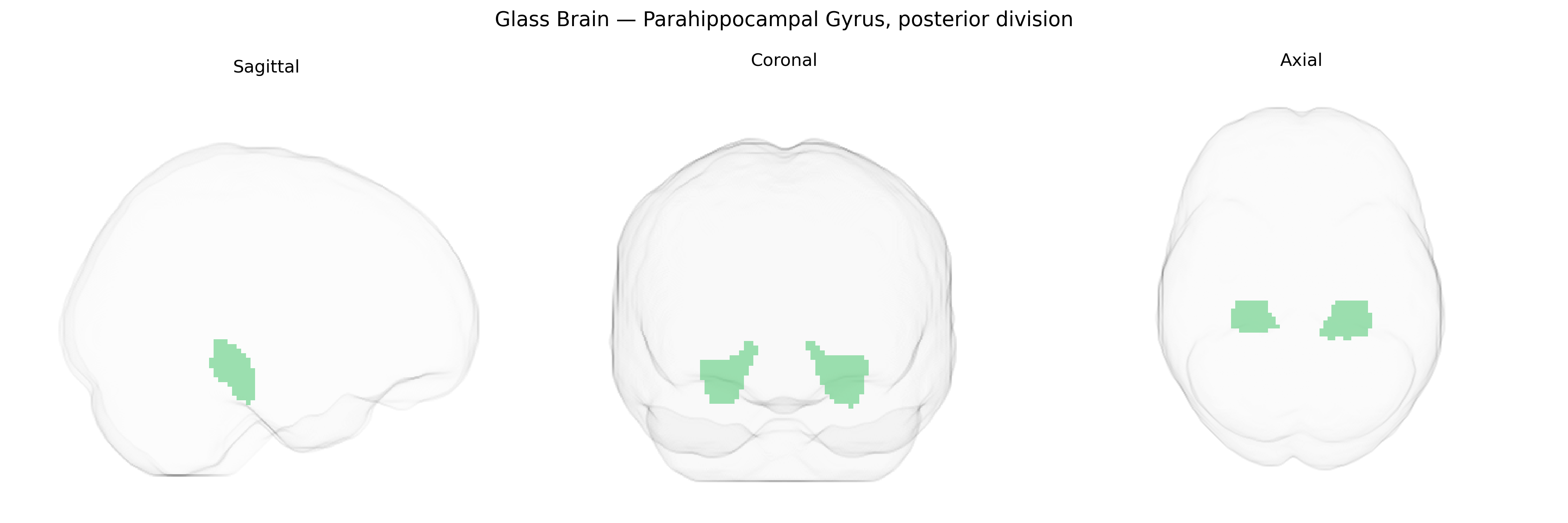 Triplanar Ghost Brain