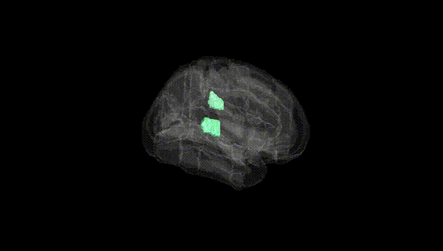 Full Brain Black