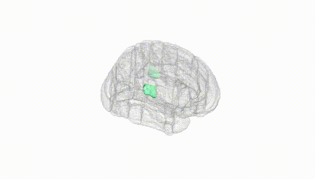 Full Brain White