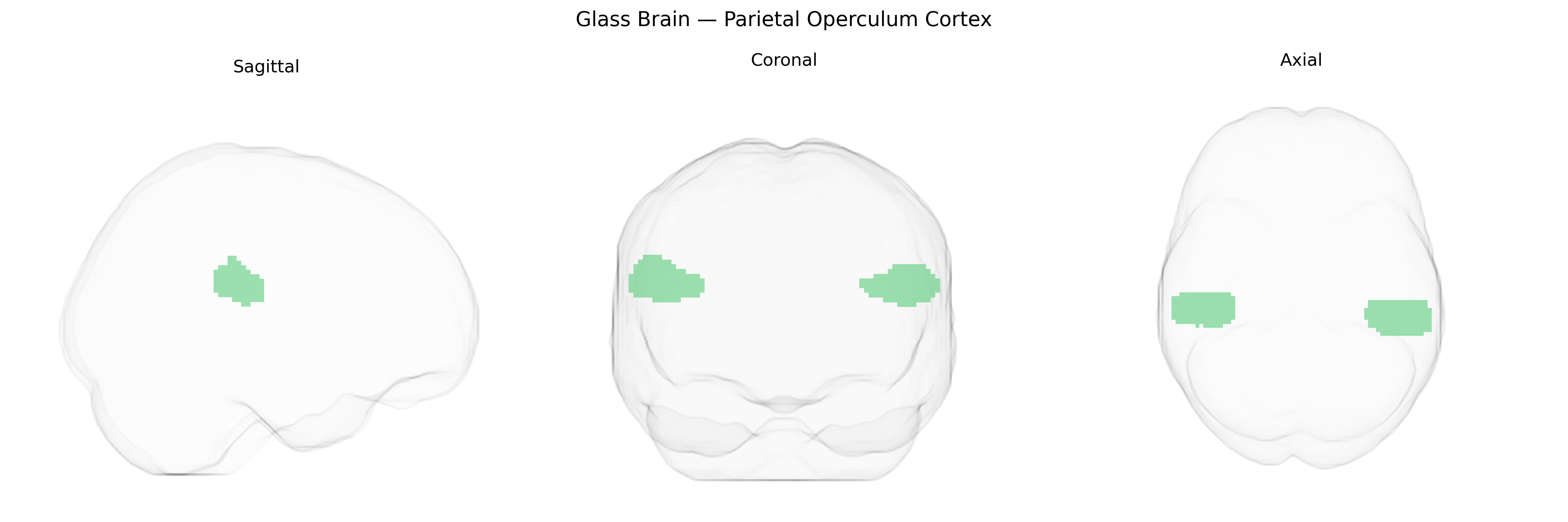 Triplanar Ghost Brain