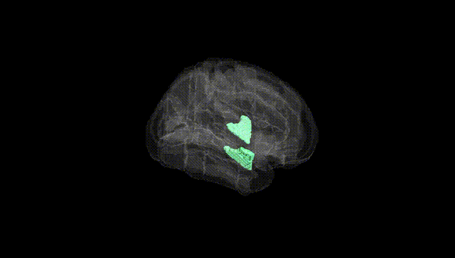 Full Brain Black