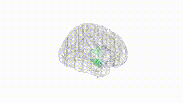 Full Brain White