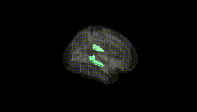 Full Brain Black