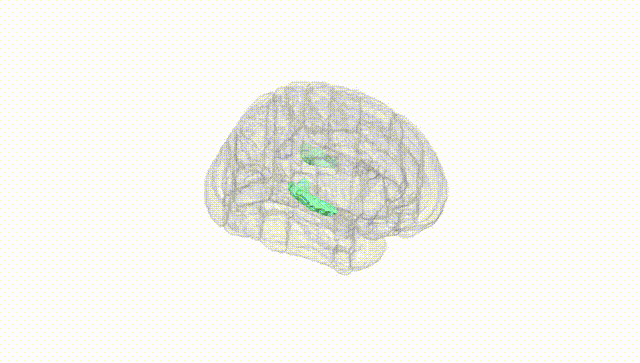 Full Brain White