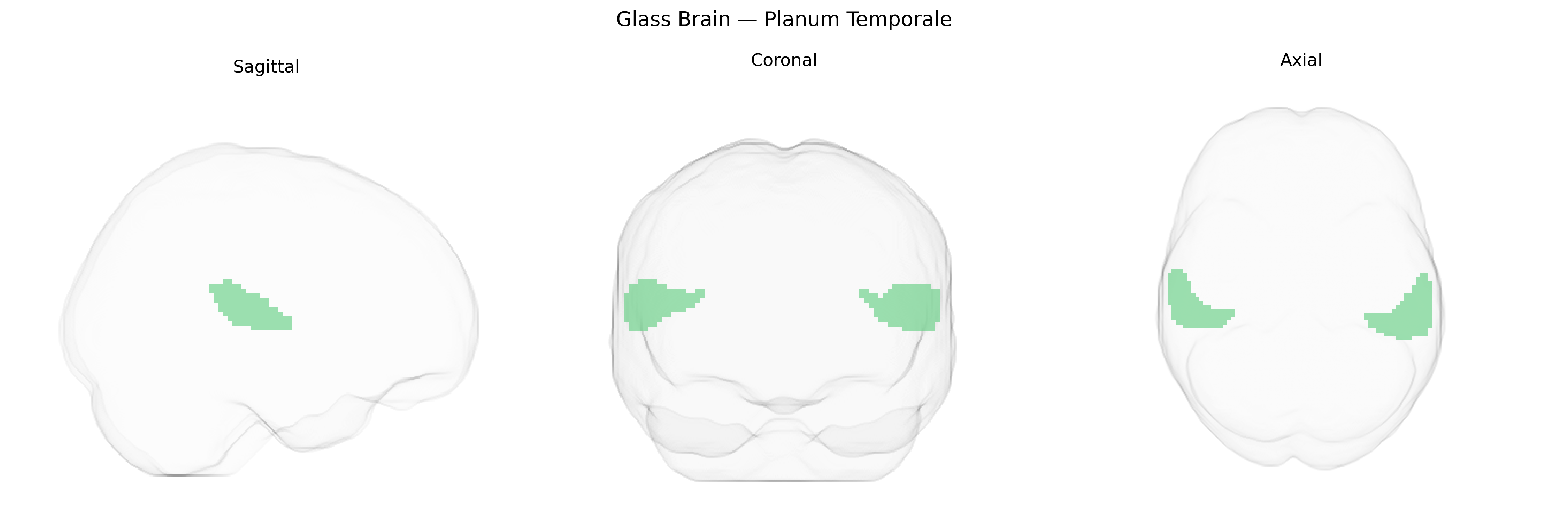 Triplanar Ghost Brain