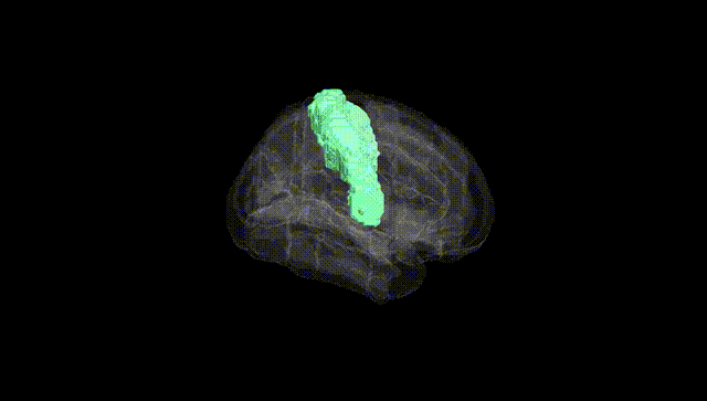 Full Brain Black