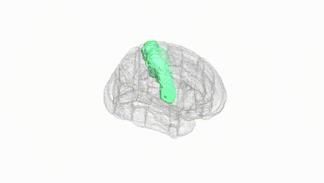 Full Brain White