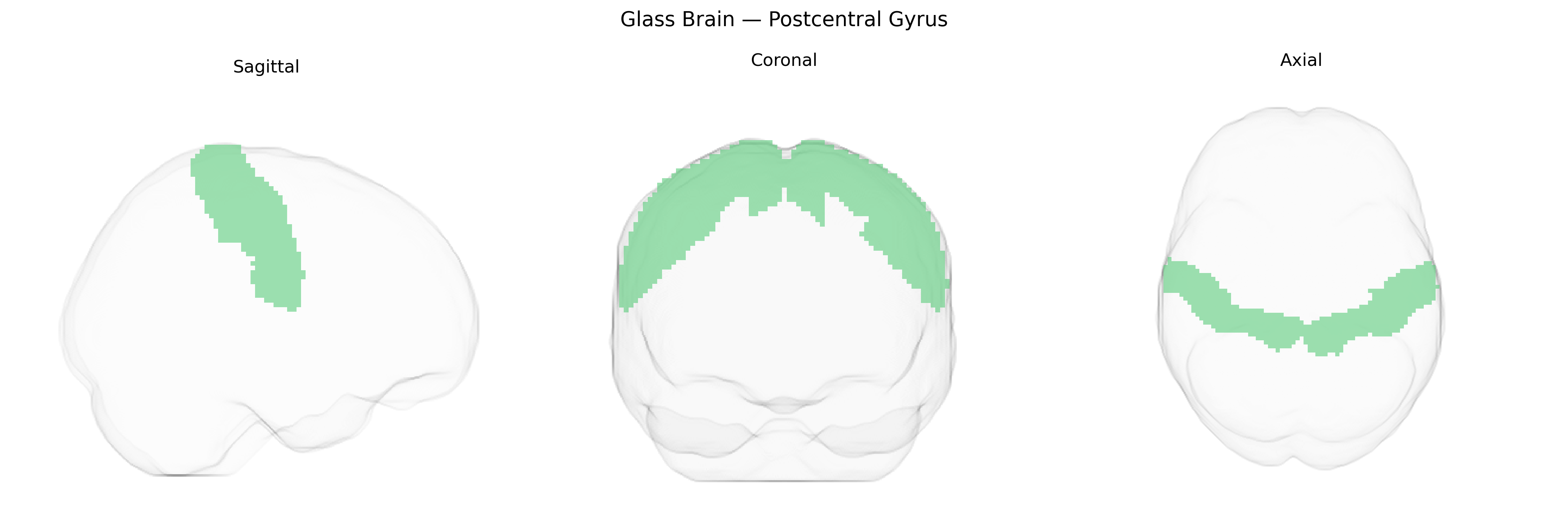 Triplanar Ghost Brain