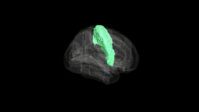 Full Brain Black
