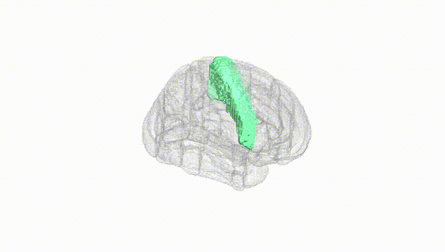 Full Brain White