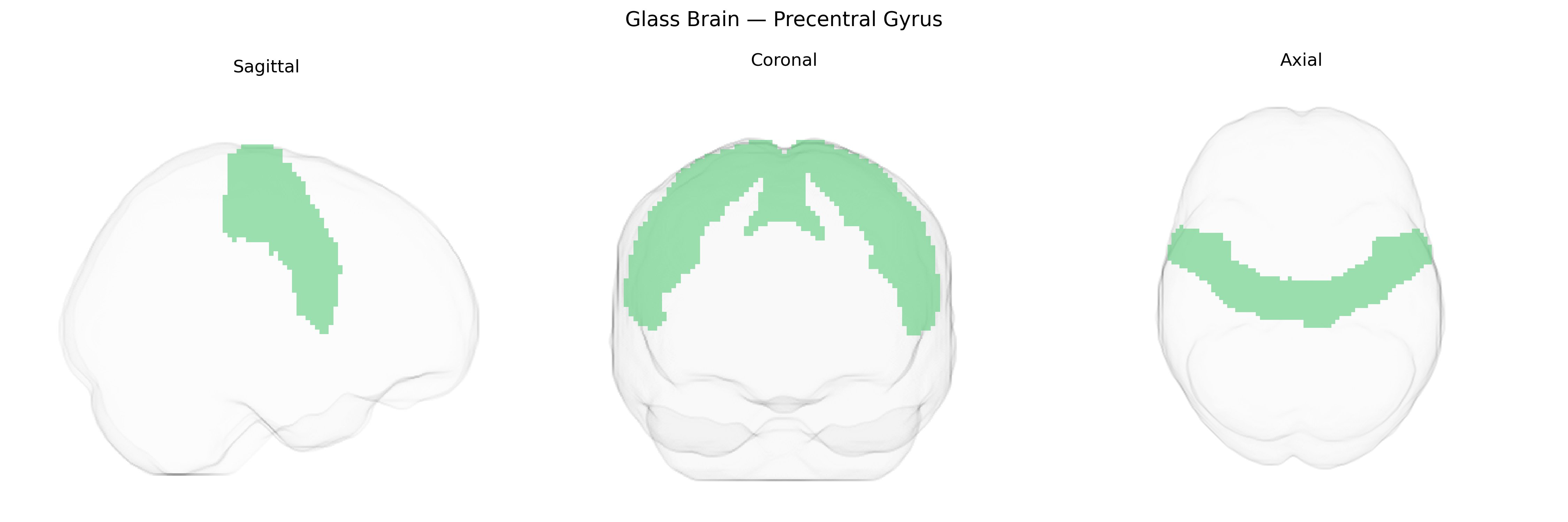 Triplanar Ghost Brain