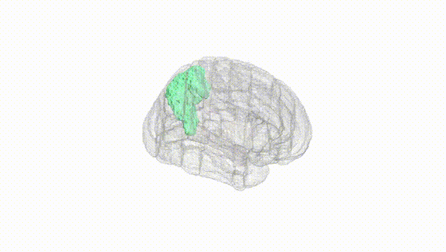 Full Brain White