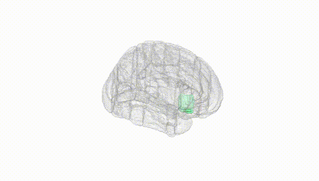 Full Brain White