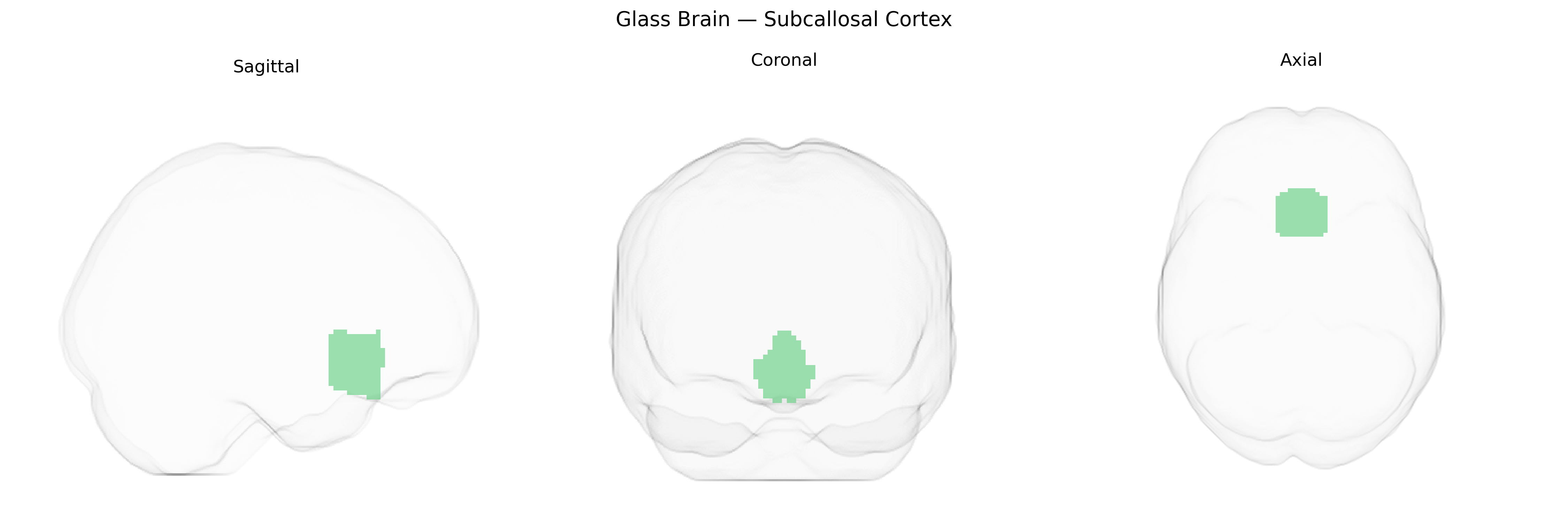 Triplanar Ghost Brain