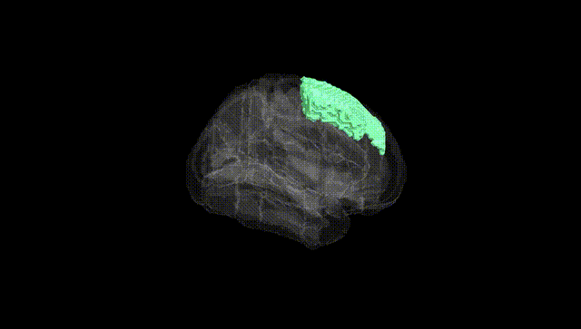 Full Brain Black