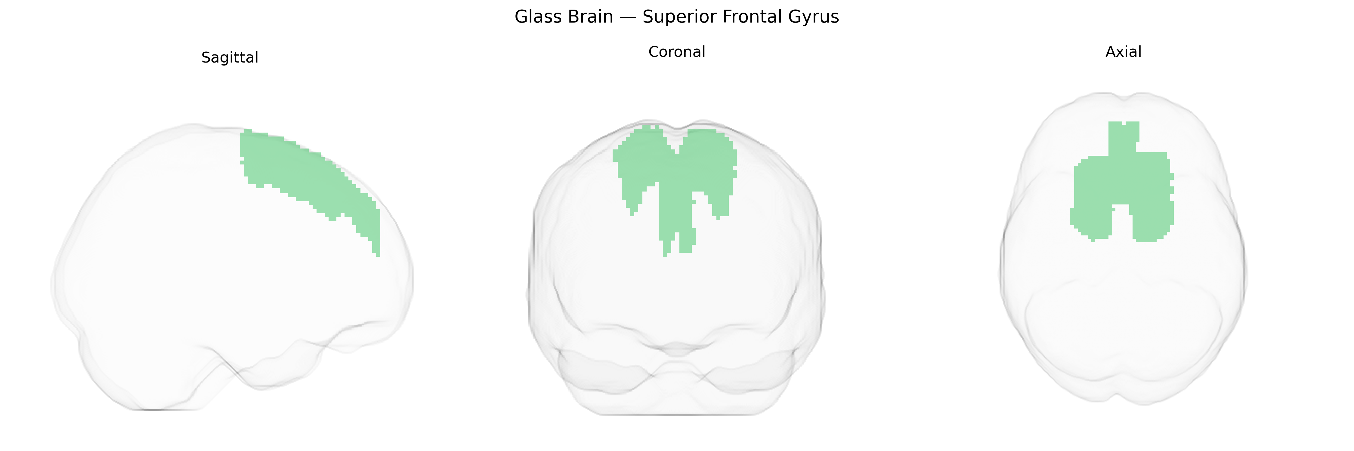 Triplanar Ghost Brain