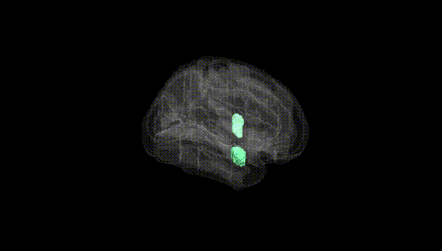 Full Brain Black