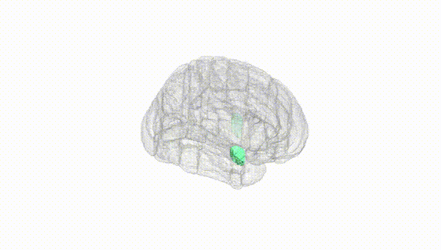 Full Brain White
