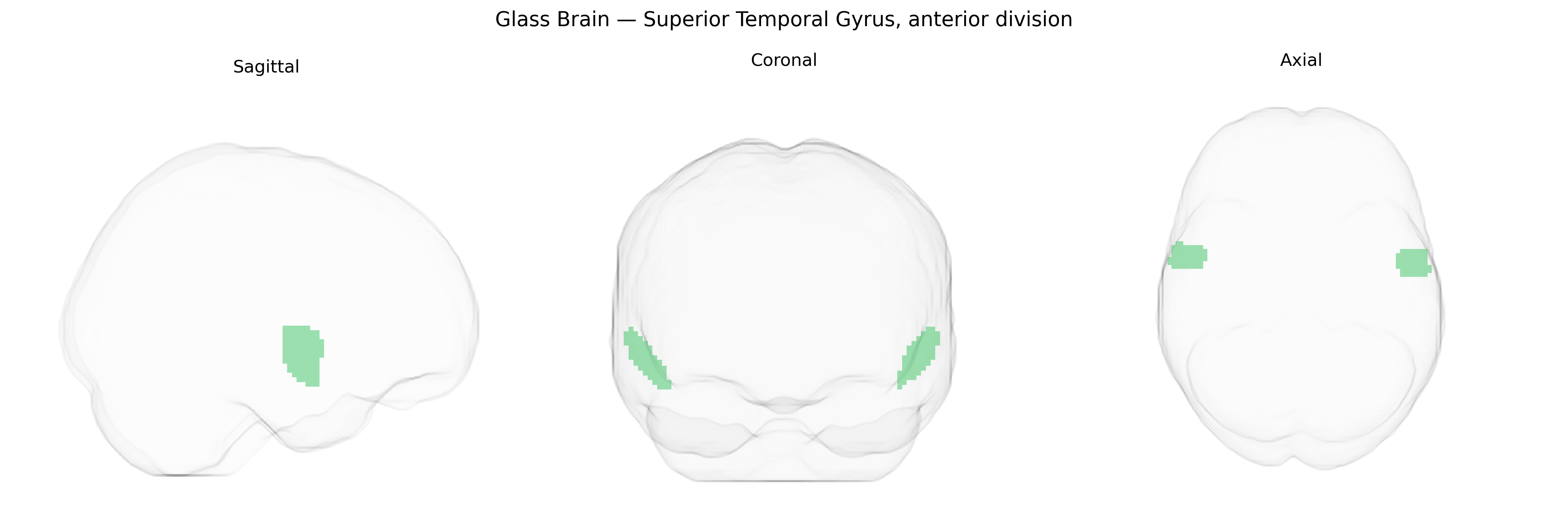 Triplanar Ghost Brain