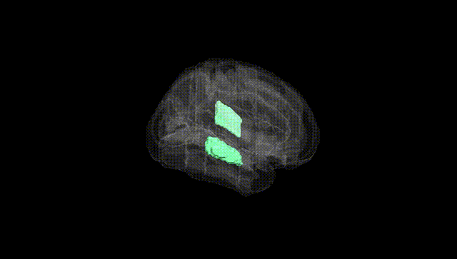 Full Brain Black