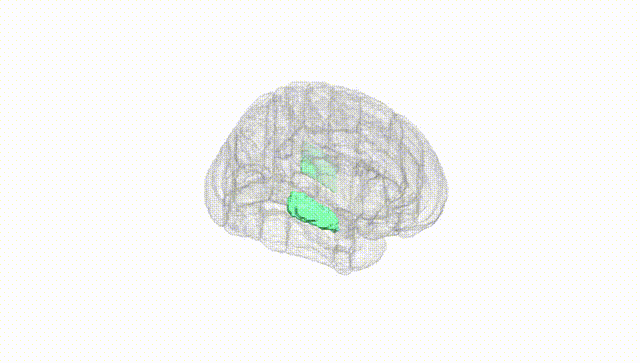 Full Brain White