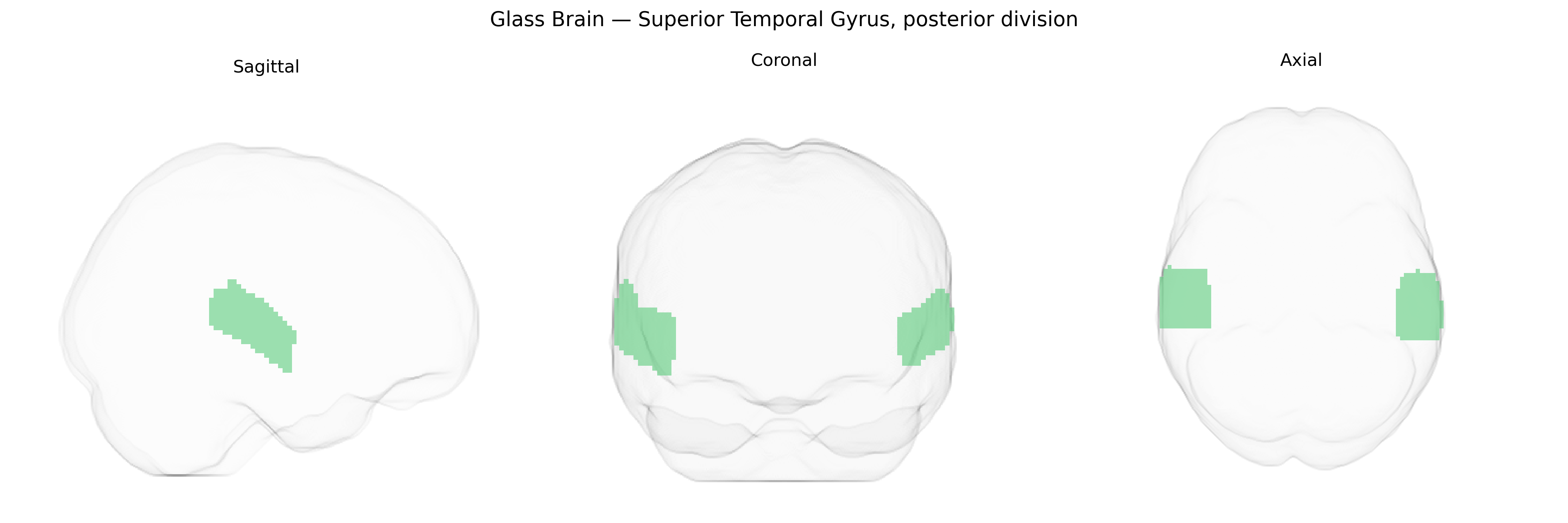 Triplanar Ghost Brain