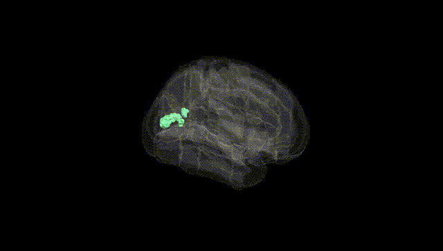 Full Brain Black