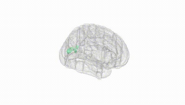 Full Brain White