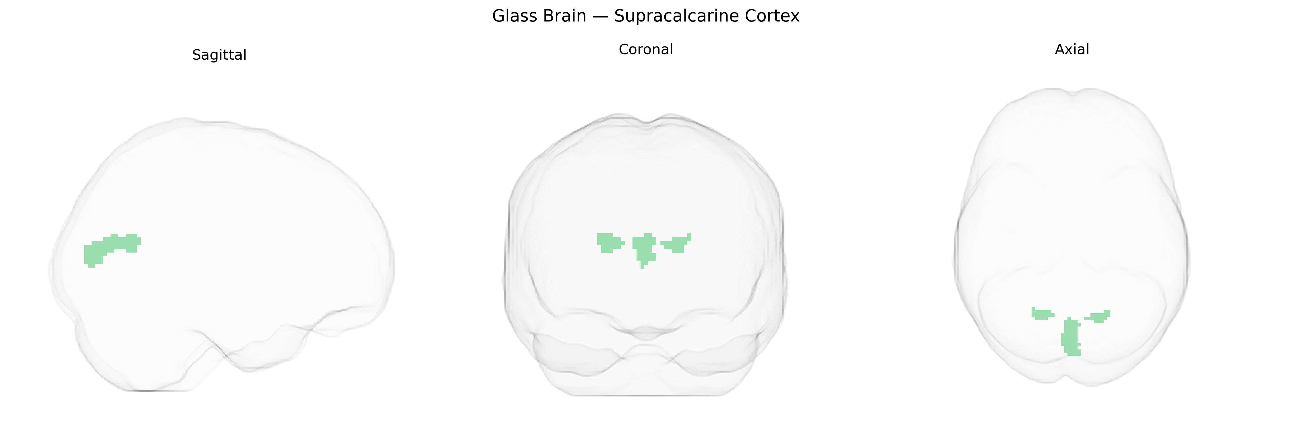 Triplanar Ghost Brain