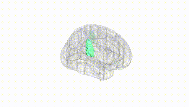 Full Brain White