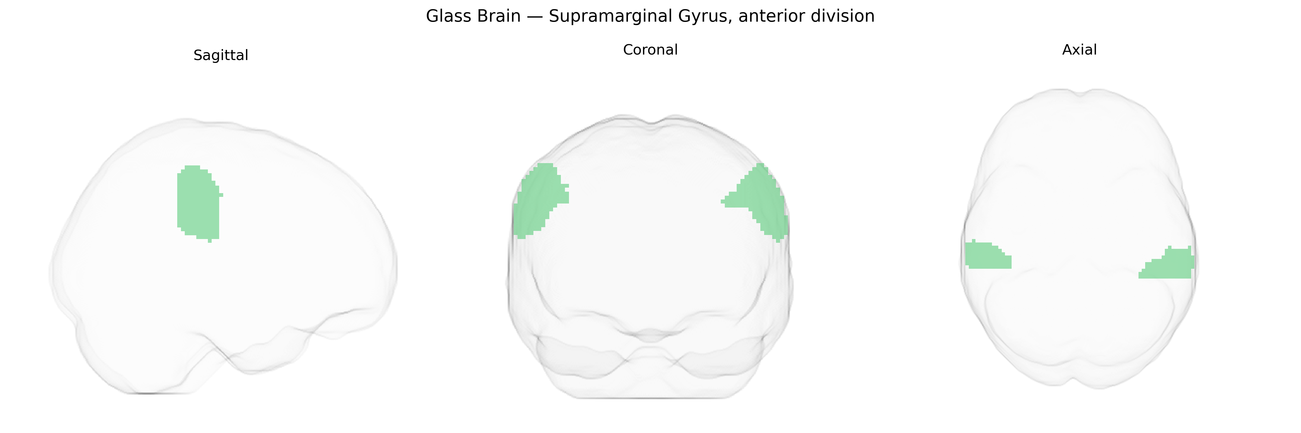 Triplanar Ghost Brain
