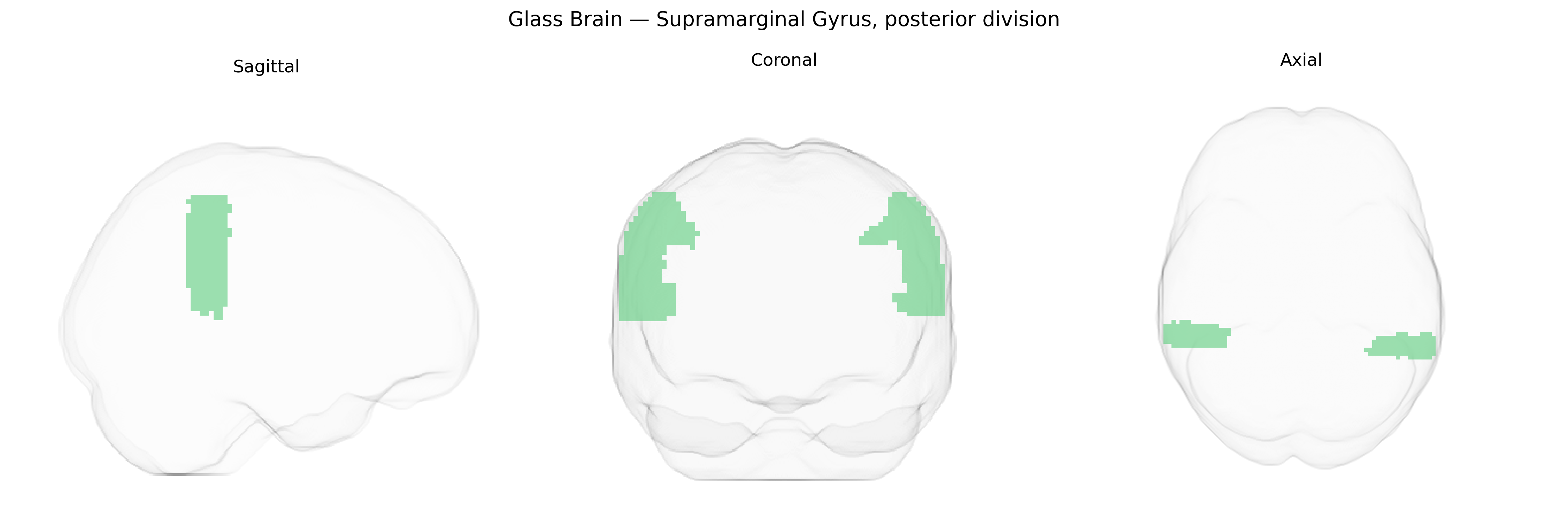 Triplanar Ghost Brain