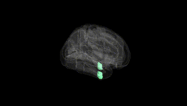 Full Brain Black