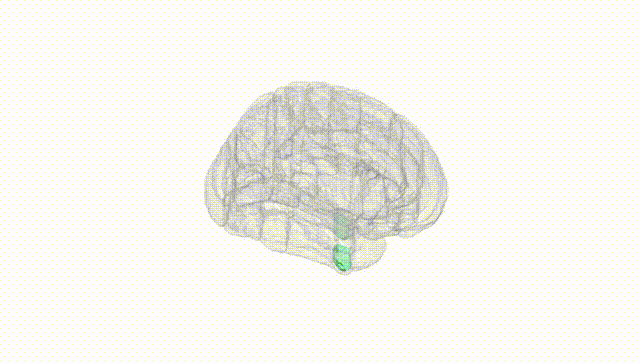 Full Brain White