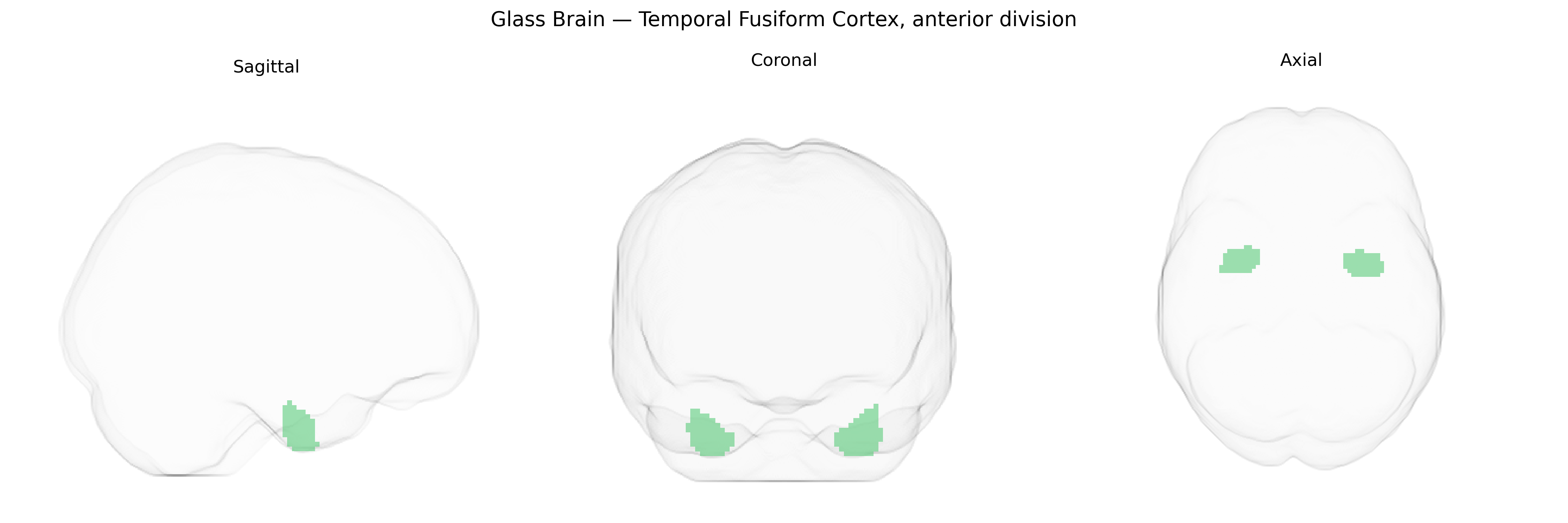 Triplanar Ghost Brain