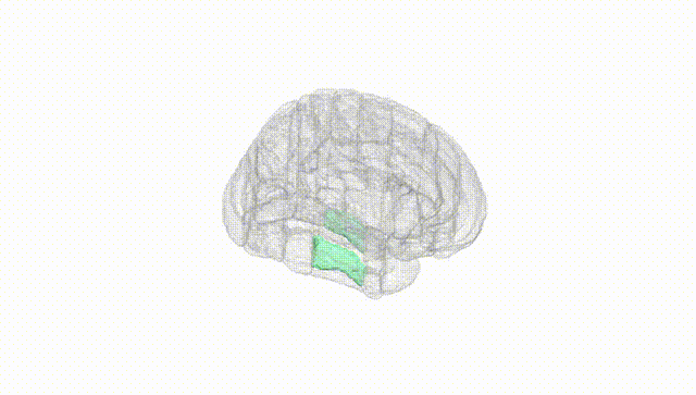 Full Brain White
